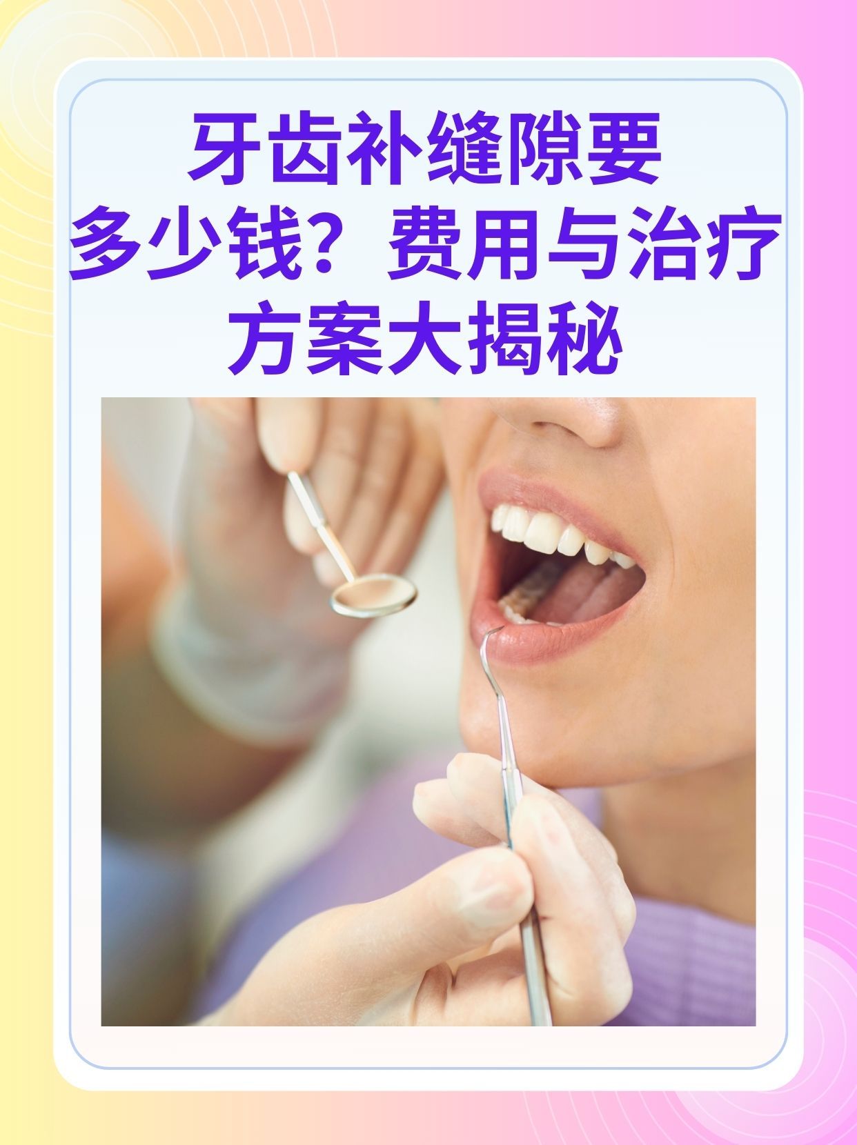 平凉补牙医保可以报销吗(补牙医保可以报销吗 哪些可以报销呢)